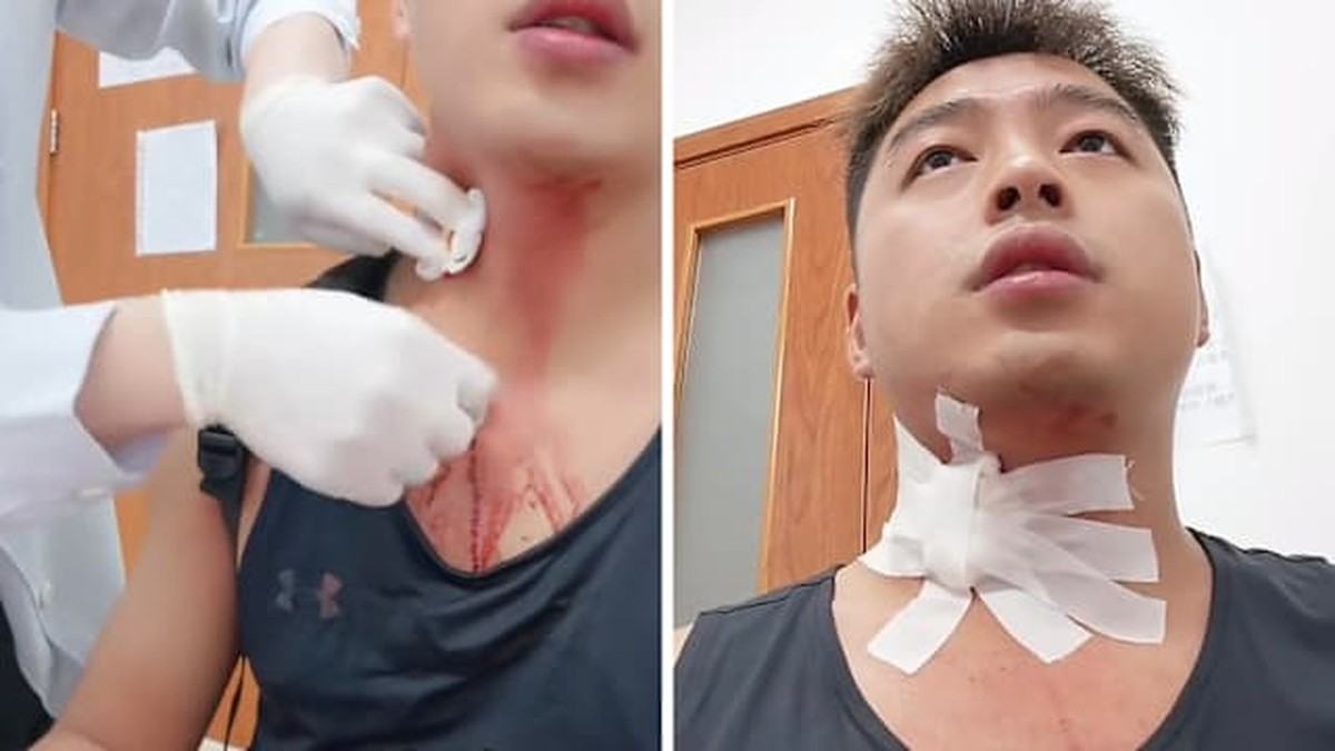Nguy Cơ Khôn Lường Khi Dập Muỗi: Câu Chuyện Chưa Từng Có